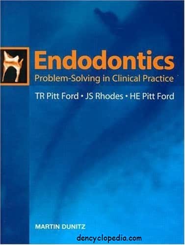 endodontics problem solving in clinical practice