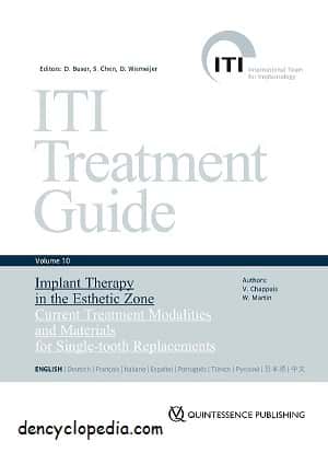 ITI Treatment Guide Volume 10 – Dencyclopedia