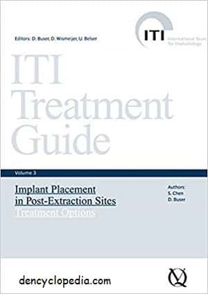 ITI Treatment Guide Volume 3 – Dencyclopedia